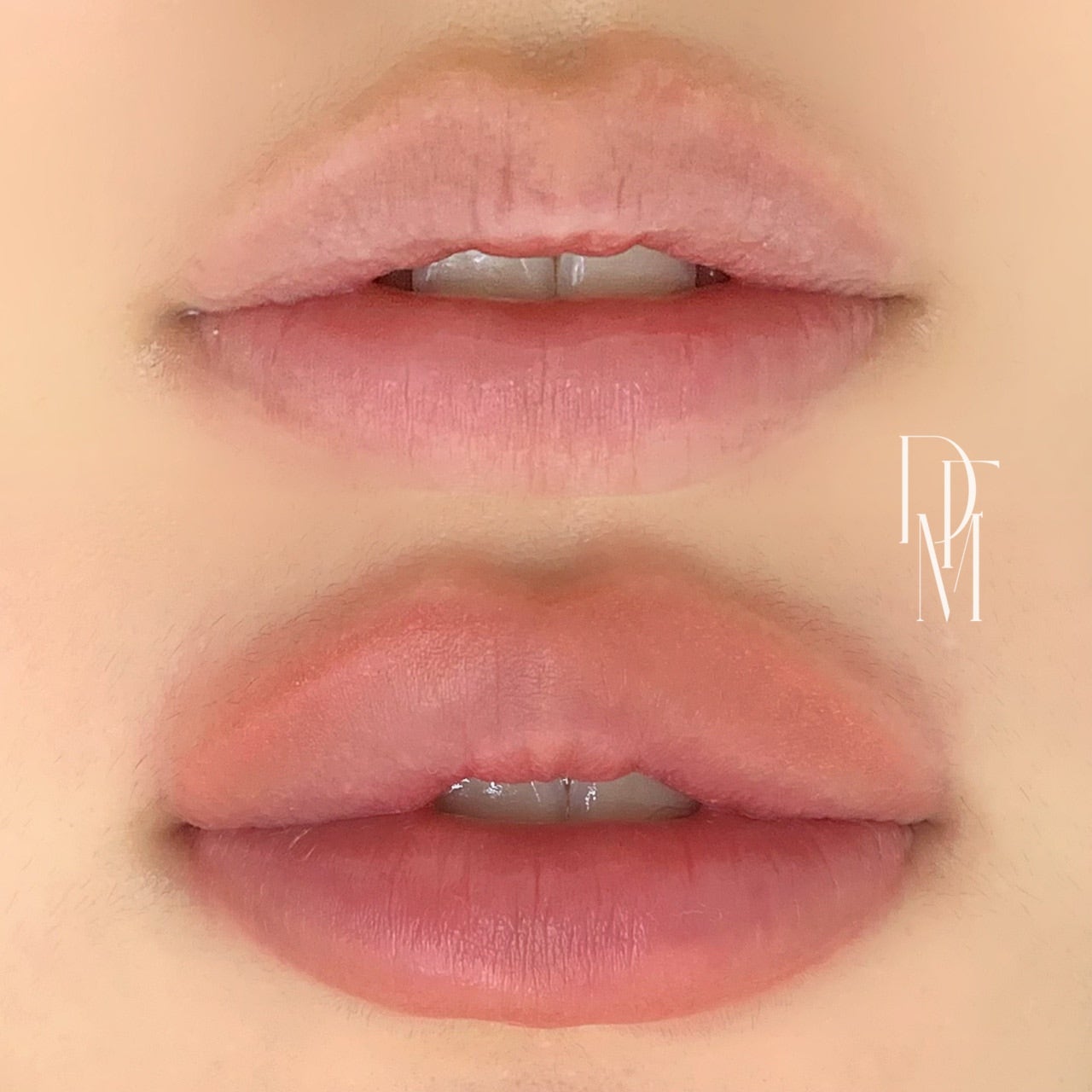 DIF.ME LIP LINE