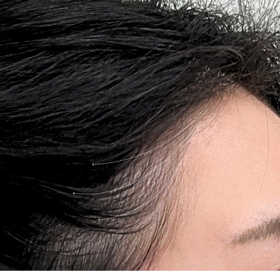 DIF.ME HAIRLINE STROKE